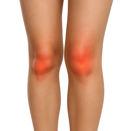 Médicaments avec des Anti-inflammatoires