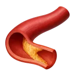Cholestérol